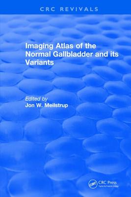 Imaging Atlas of the Normal Gallbladder and Its Variants