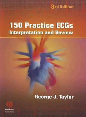 150 Practice ECGs