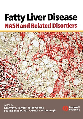 Fatty Liver Disease