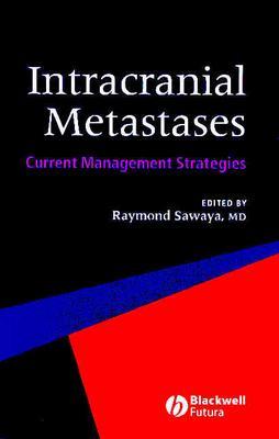 Intracranial Metastases