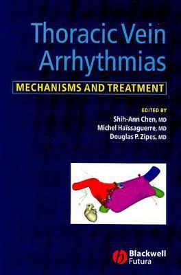 Thoracic Vein Arrhythmias