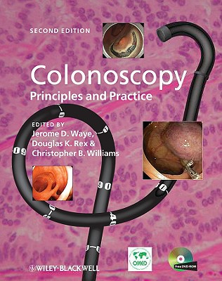 Colonoscopy 2e