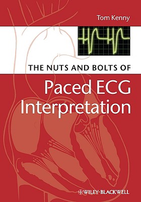 The Nuts and bolts of Paced ECG Interpretation