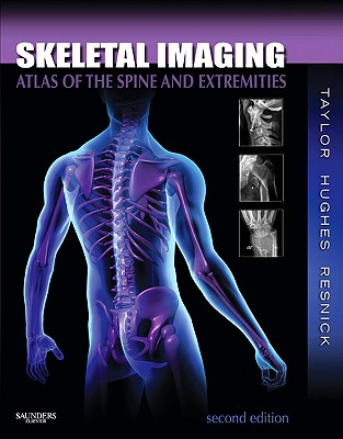 Skeletal Imaging