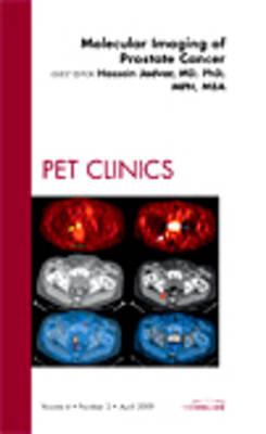 Molecular Imaging of Prostate Cancer, An Issue of PET Clinics