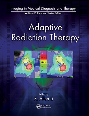 Adaptive Radiation Therapy