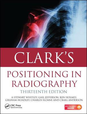 Clark''s Positioning in Radiography