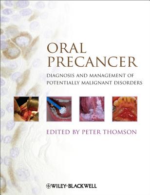 Oral Precancer