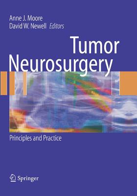 Tumor Neurosurgery