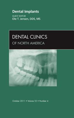 Dental Implants, An Issue of Dental Clinics