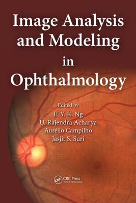 Image Analysis and Modeling in Ophthalmology