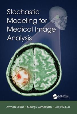 Stochastic Modeling for Medical Image Analysis