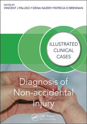 Diagnosis of Non-accidental Injury