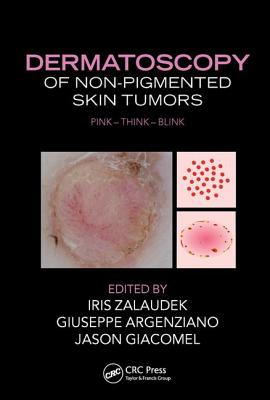 Dermatoscopy of Non-Pigmented Skin Tumors