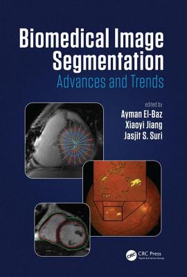 Biomedical Image Segmentation