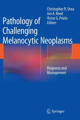 Pathology of Challenging Melanocytic Neoplasms