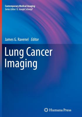 Lung Cancer Imaging