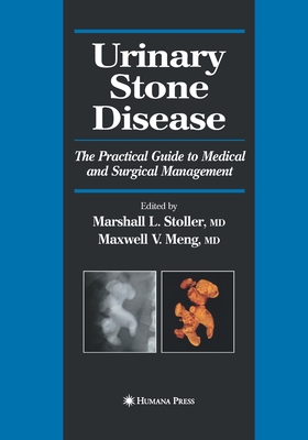 Urinary Stone Disease