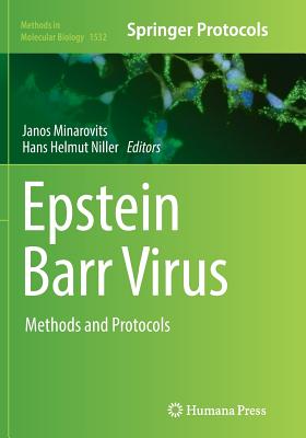 Epstein Barr Virus