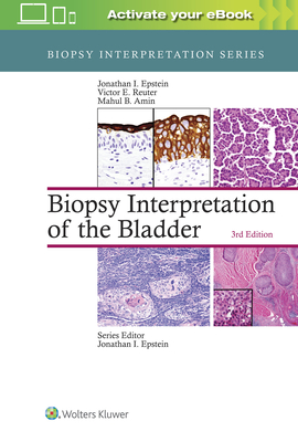 Biopsy Interpretation of the Bladder