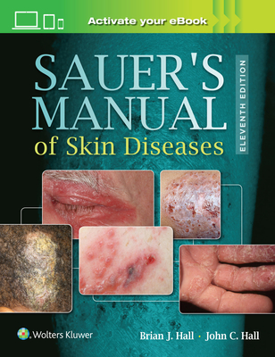Sauer''s Manual of Skin Diseases