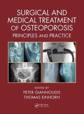 Surgical and Medical Treatment of Osteoporosis