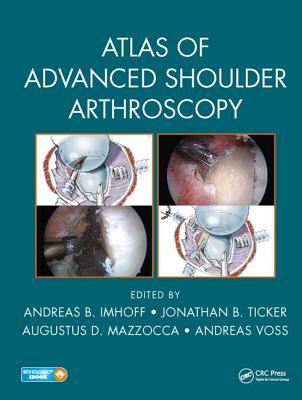 Atlas of Advanced Shoulder Arthroscopy