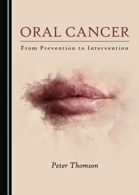 Oral Cancer