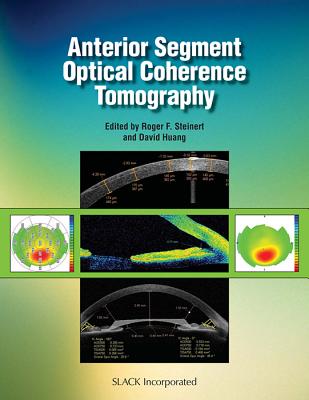 Anterior Segment Optical Coherence Tomography