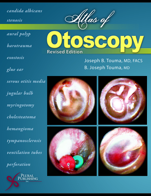 Atlas of Otoscopy