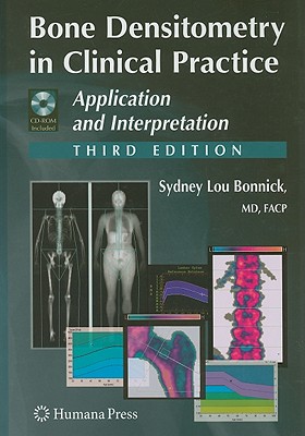 Bone Densitometry in Clinical Practice