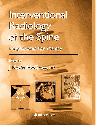 Interventional Radiology of the Spine