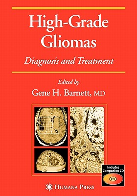 High-Grade Gliomas