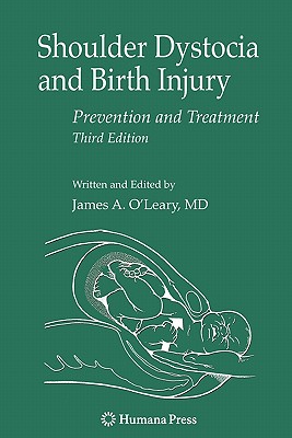 Shoulder Dystocia and Birth Injury