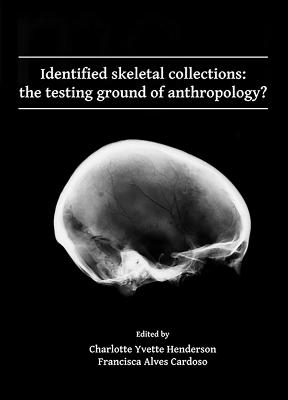 Identified skeletal collections: the testing ground of anthropology?