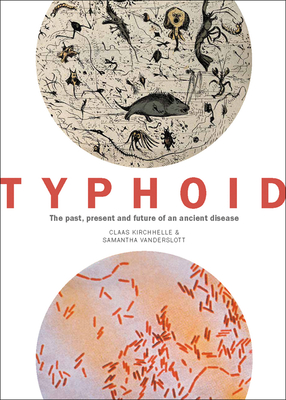 Typhoid