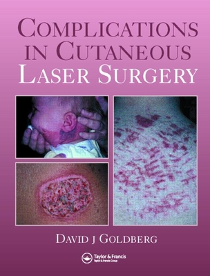 Complications in Cutaneous Laser Surgery