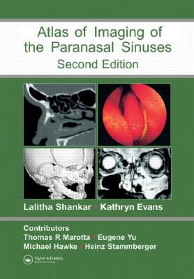 Atlas of Imaging of the Paranasal Sinuses, Second Edition