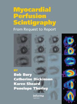 Myocardial Perfusion Scintigraphy