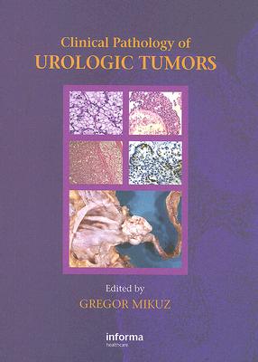 Clinical Pathology of Urological Tumours