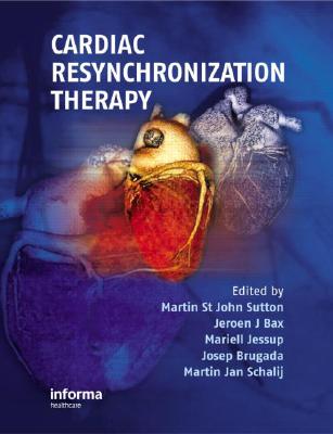 Cardiac Resynchronization Therapy