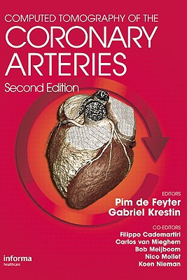 Computed Tomography of the Coronary Arteries