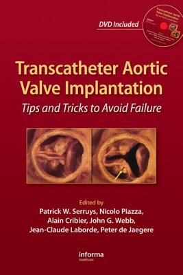 Transcatheter Aortic Valve Implantation