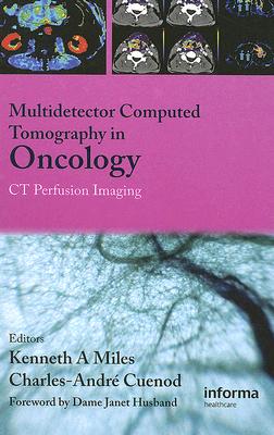 Multi-Detector Computed Tomography in Oncology