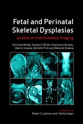 Fetal and Perinatal Skeletal Dysplasias