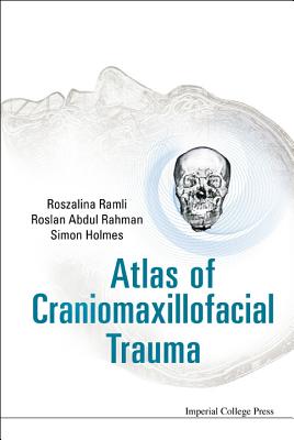 Atlas Of Craniomaxillofacial Trauma