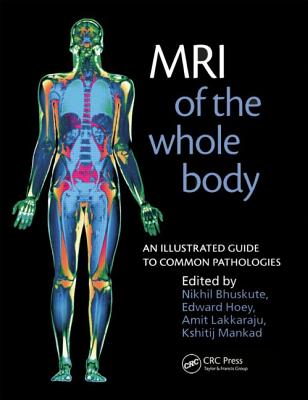 MRI of the Whole Body