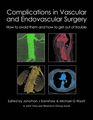 Complications in Vascular and Endovascular Surgery