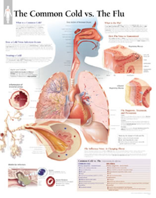 Common Cold vs the Flu Laminated Poster