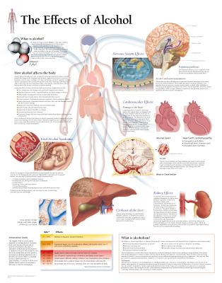 Effects of Alcohol Laminated Poster